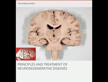 Tablet Screenshot of neurodegeneration.webnode.com