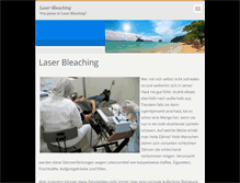 Tablet Screenshot of laserbleaching.webnode.com