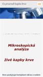 Mobile Screenshot of kapkakrve.webnode.cz