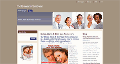 Desktop Screenshot of moleswartsremoval1.webnode.es