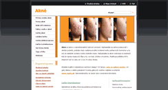 Desktop Screenshot of akne.webnode.sk