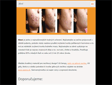 Tablet Screenshot of akne.webnode.sk