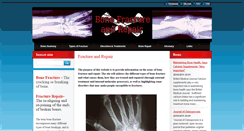 Desktop Screenshot of bonefracturerepair.webnode.com